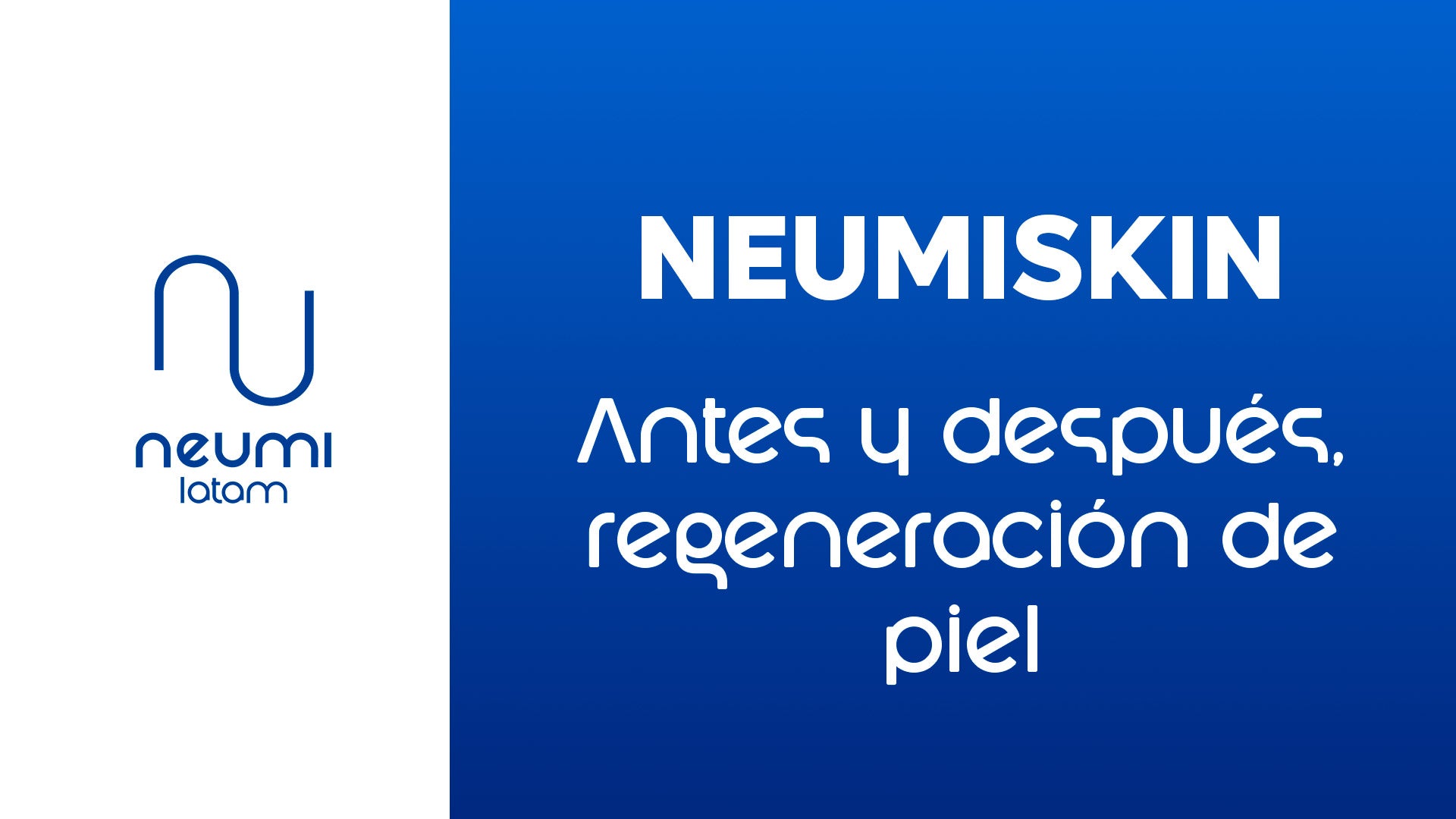 Cargar video: 